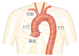 胸部大動脈