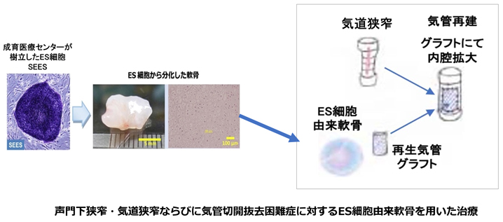 ES細胞（胚性幹細胞）から作成した軟骨でのパッチグラフト移植